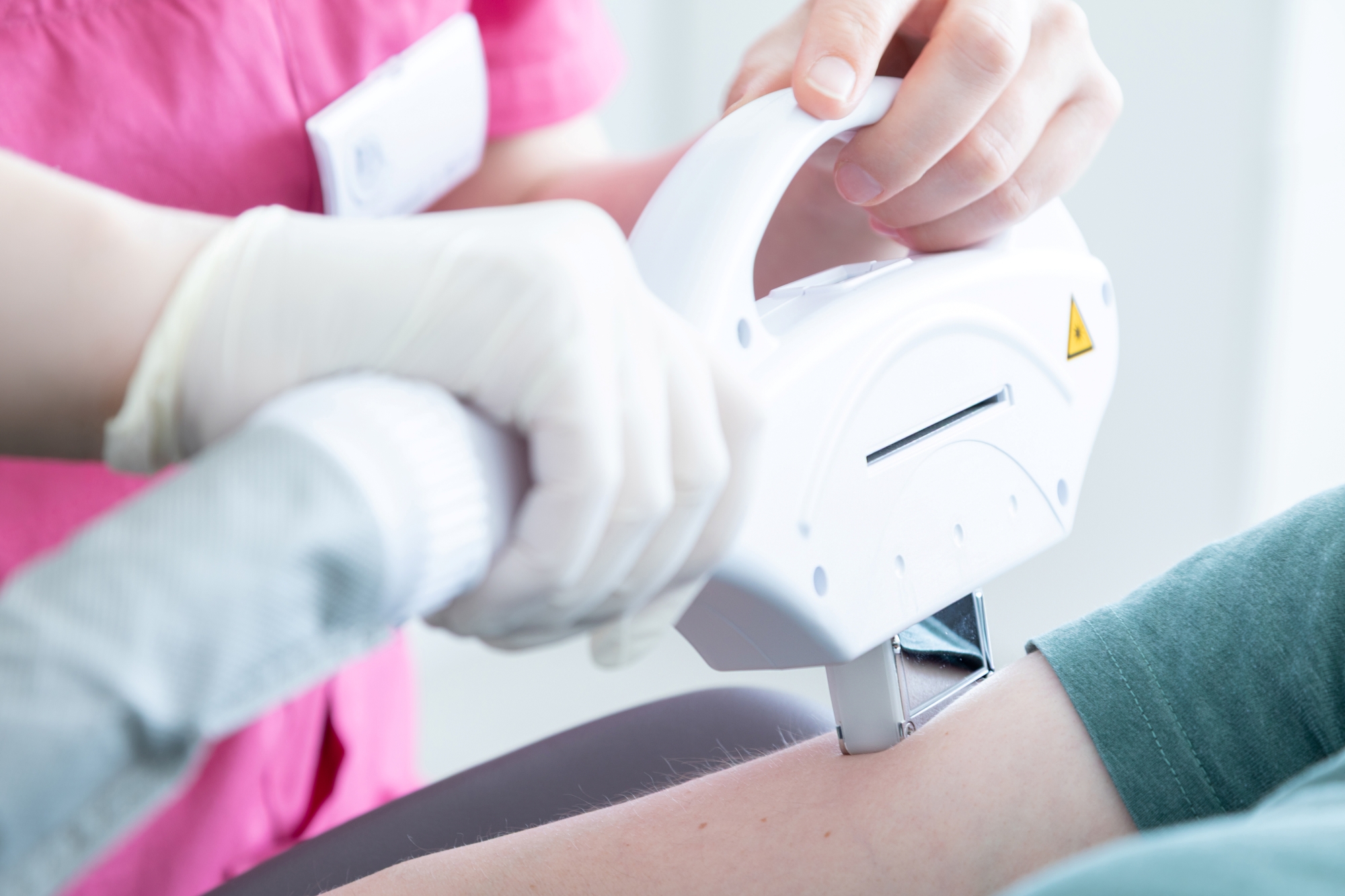 Laserbehandlung am Unterarm in unserer Praxis