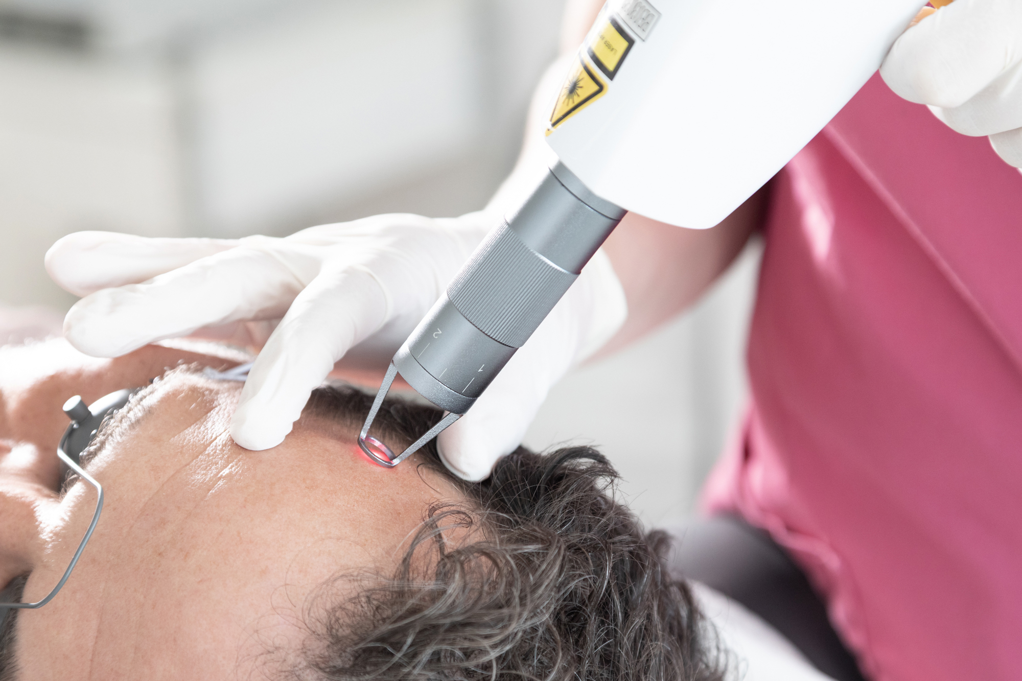 Laserbehandlung an der Stirn eines Patienten
