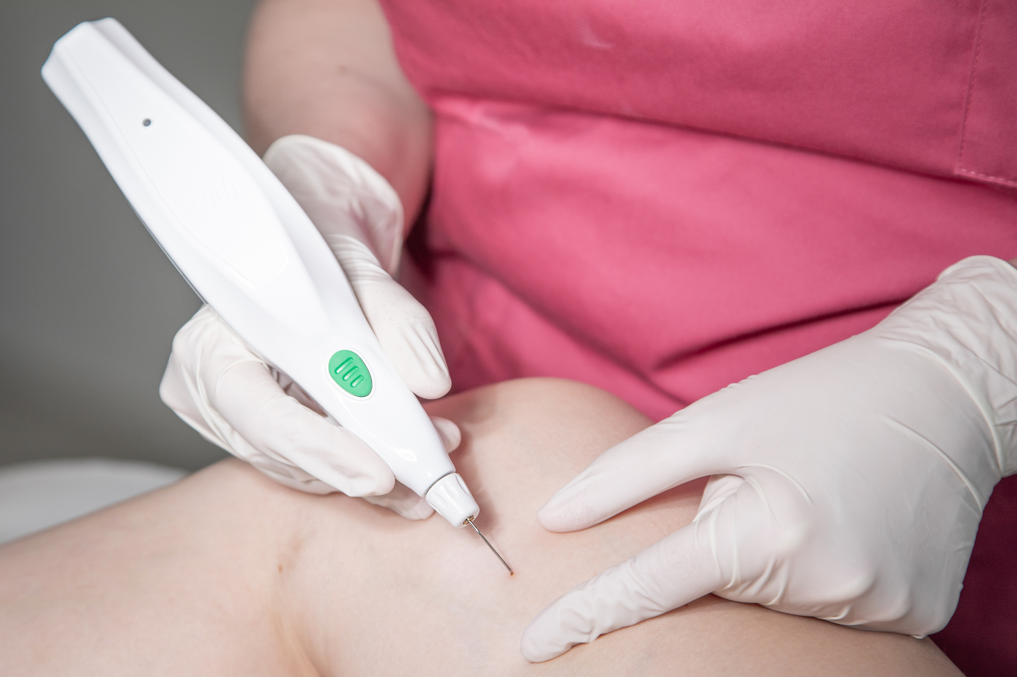 Ruhige Praxisszene mit PlexR®-Plasma-Applikator